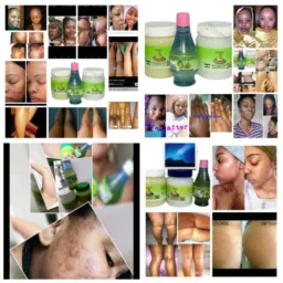 Ladies gadzirai skin naturally 🍑