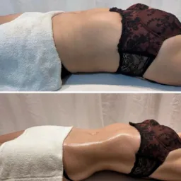 Procedimentos Estéticos e Massagens.💃🏻💄👙